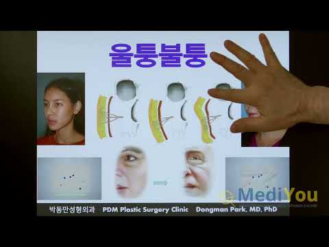 박동만 성형외과 Facelift