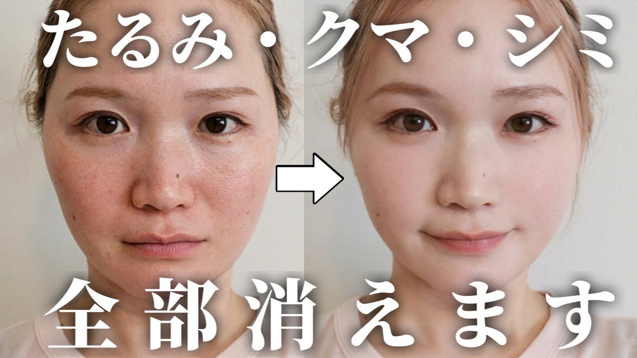 【別人級】クマ・たるみ・シミを一瞬でカバーする！30代でも-5歳若見えするコンシーラーテクニック｜最近、整形しました！