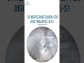 S1 Nerve Root Injection For Disc Prolapse L5 S1 Under Fluoroscopy Guidance