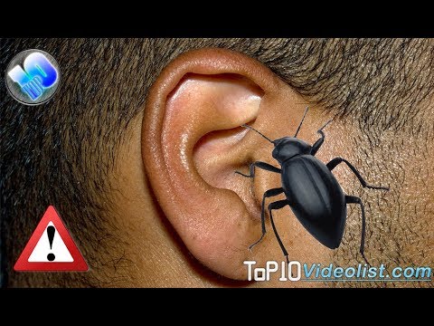 Top 10 Horrifying Things Ever found Inside a Human Ears