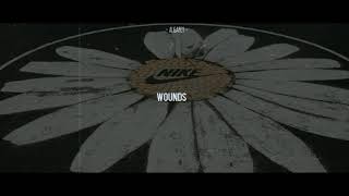 Download lagu HA YOONBIN 하윤빈 [ BEN ] - WOUNDS [ ROM LYRICS ] mp3