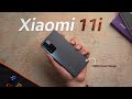 Xiaomi 11i HyperCharge 120W But