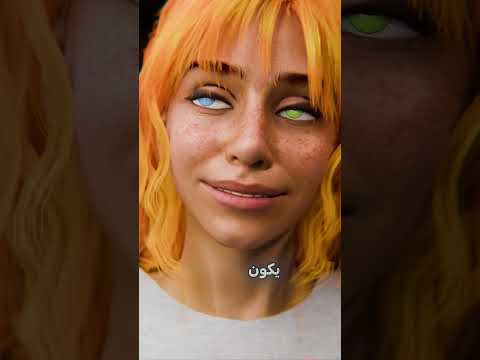 اعطيت كليتي لمديري 😱 #shortvideo