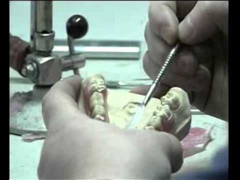 Dentallabor Bautzen: Valplast - die flexible Alternative!