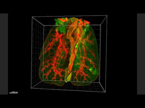 PLISH In situ hybridization of thick human lung tissue For SFTPC, MIR29-1, and AXIN2