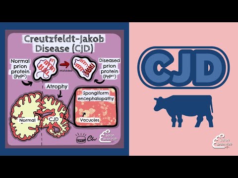 Creutzfeldt-Jakob-Krankheit (CJK)
