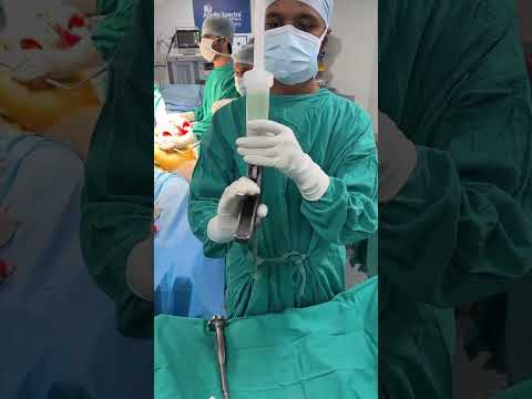 WHAT IS THIS CALLED? #drpankajwalecha #orthopedicsurgeon #orthopedics