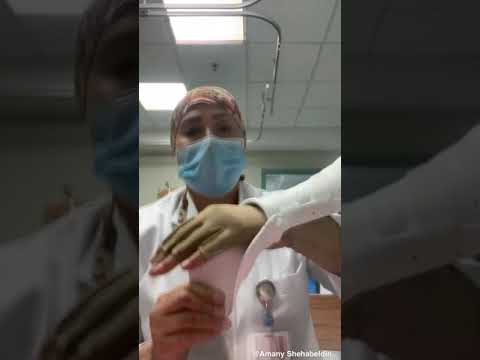 Anti claw hand splint