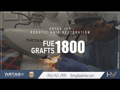 Robotic Hair Restoration at Hair By Dr. Max (Fort Lauderdale, Florida)