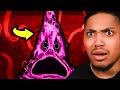 The Spongebob Infected AU