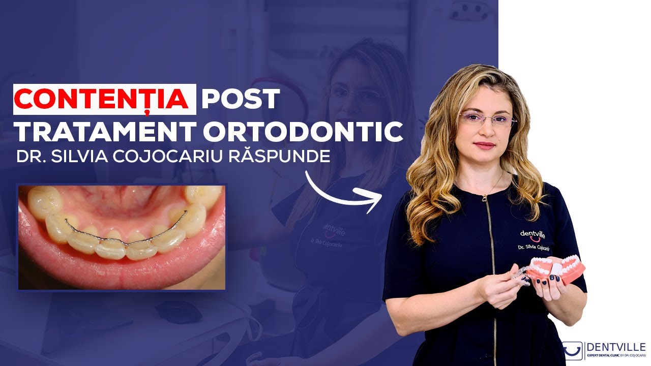 <div style="text-align: left; white-space: normal; overflow: hidden; display: -webkit-box; -webkit-line-clamp: 2; -webkit-box-orient: vertical; line-height: 1.3em;">Contenția post tratament ortodontic | Dr. Silvia Cojocariu | Dentville</div>