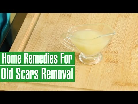 古い傷を取り除くための3つの効果的なホームレメディ (3 Effective Home Remedies To Remove Old Scars)