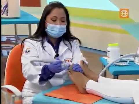 Si tiene que quitar la uña al hongo El calendario del tratamiento de las uñas por de luna el calendario