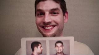 Michael Cooper Has His Braces Off!