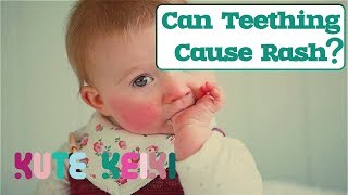 Can Teething Cause Rash in Babies? - Natural Teething Rash Remedies