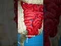 What Is A Hookworm? 😨 🪱