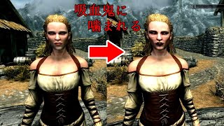 【Skyrim】スカイリム　吸血鬼に嚙まれると