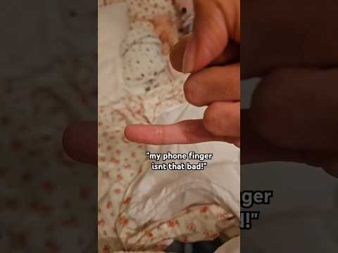 yeah it's pretty bad😭 #relatable #phone #reletable #fypviral #fyp #foryoupage #foryou #viral #famous