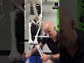 Knock Knees