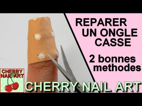 comment reparer des ongles rongés
