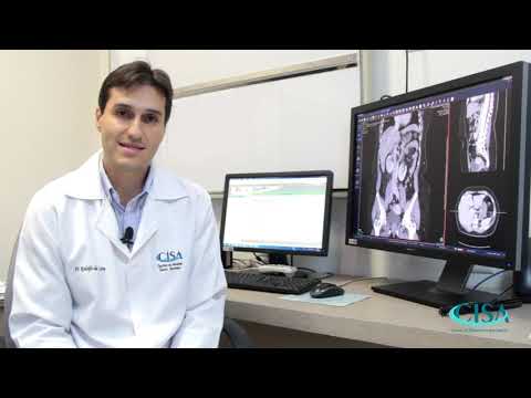 Tomografia Computadorizada