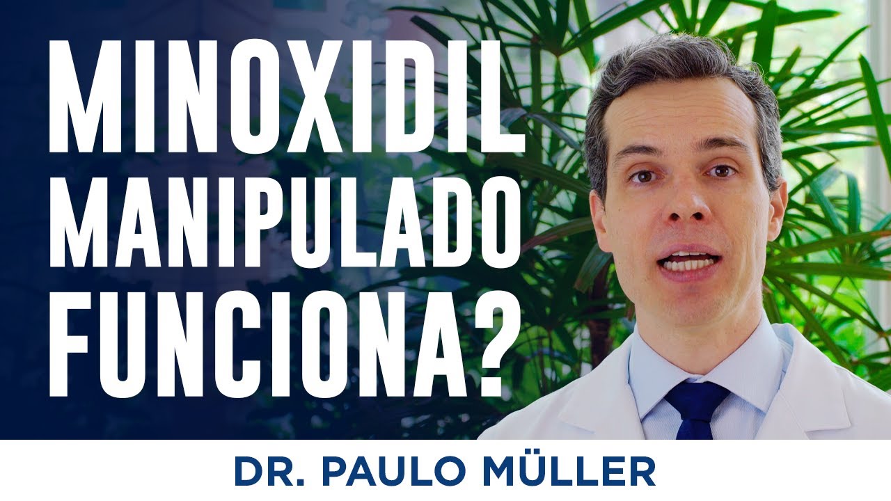 Minoxidil Manipulado Funciona  Dr. Paulo Müller Dermatologista