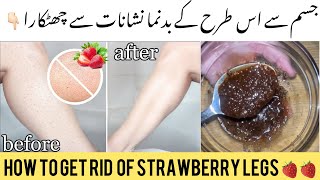 Get rid of strawberry legs | Tiny bumps & body acne Treatment At Home | Smooth skin after wax |
