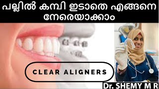 How to CORRECT TEETH WITHOUT BRACES_Eng.sub| CLEAR ALIGNERS| DENTAL ALIGNERS 2021|Malayalam|Dr SHEMY