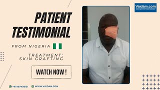 Patient from Nigeria shares his pleasant experience with Skin Grafting in Gurgaon, India