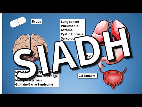 SIADH EXPLAINED (Hyponatraemia)