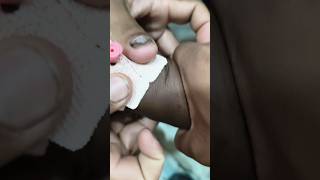 pharma.. motivated.. videos part 1065 #shorts #viral #trending #cannula