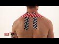 Rocktape - Kinesiology Tape Instruction - Neck