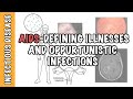 Opportunistic Infections And AIDS Defining Illnesses CD4 Cell Count Malignancy Treatment