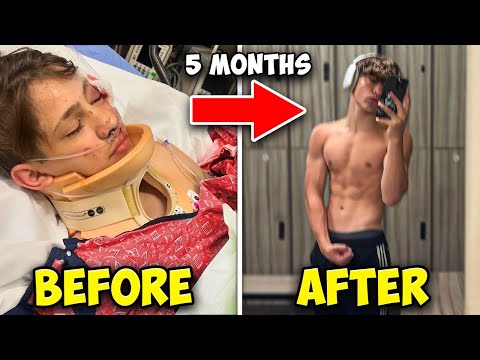 5 months after the accident.. - YouTube