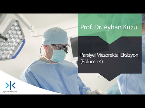 Parsiyel Mezorektal Eksizyon: Bölüm 14