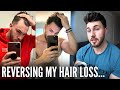 HOW I REVERSED MY HAIR LOSS | GYNO SCARE & SIDE EFFECTS…