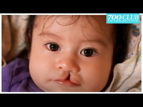 "They were like angels" - Life Changing Surgery