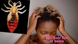 HOW TO KILL HAIR LICE AT HOME (with 2 easy steps) THAT WORKS / how to get rid of lice