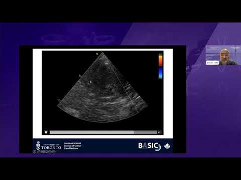 11. POCUS for hemodynamic instability outside the OR: the heart & beyond - Dr. Alberto Goffi
