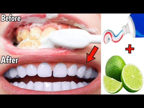 Teeth whitening and tartar drop in one minute, remove yellowing and make teeth white
