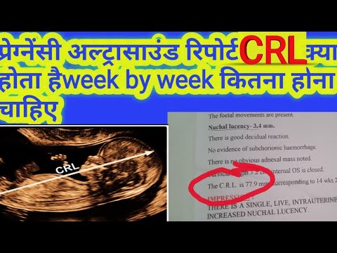 What is CRL in pregnancy ultrasound// baby CRL week by week in pregancy