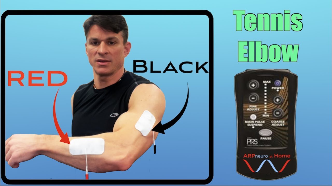 Tennis Elbow Lateral Epicondylitis Pad Placement and Movement Protocol To Help Eliminate Elbow Pain