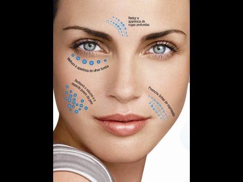 Se è possibile a zucca di dermatite atopic Eczema su mani i migliori mezzi