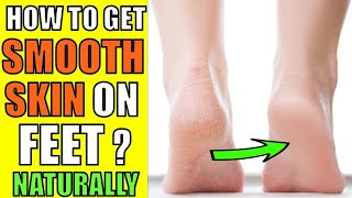 How to get SMOOTH SKIN on Feet Naturally