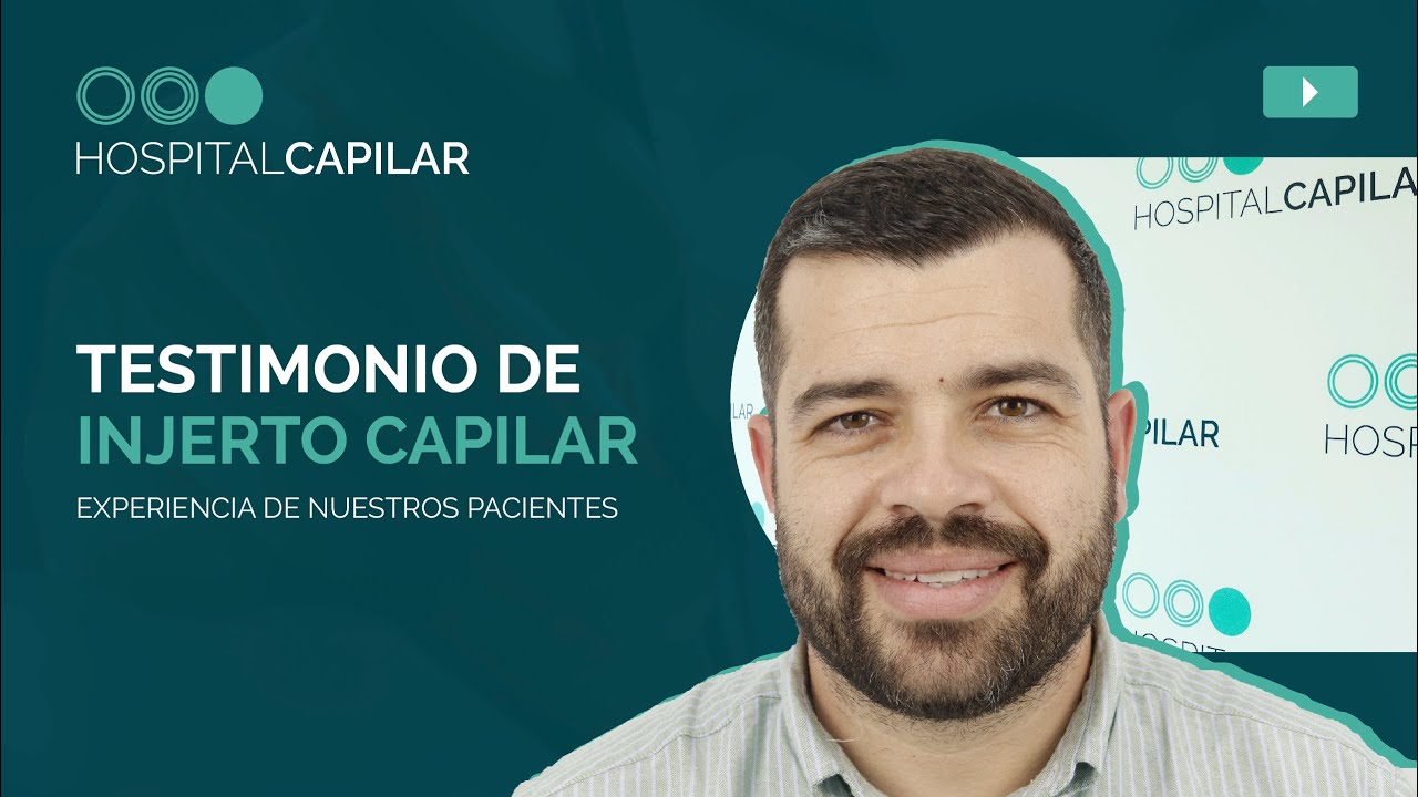 📣Hair graft TESTIMONY | The EXPERIENCE of our patients is key ☝🏼