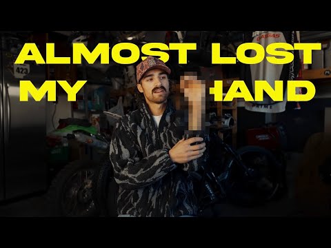 How I Almost Lost My Hand
