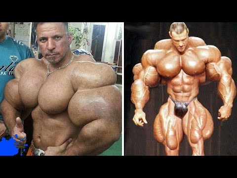 hipertenzije i todikamp u području boli uho u hipertenziji