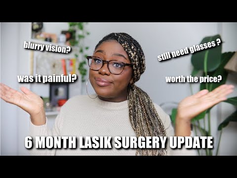 The TRUTH about LASIK EYE SURGERY | 6 Month Update