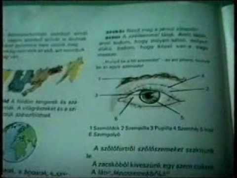 Rossz látás és szemfájdalom