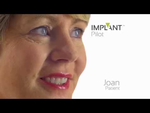 ImplantPilot™ Advert